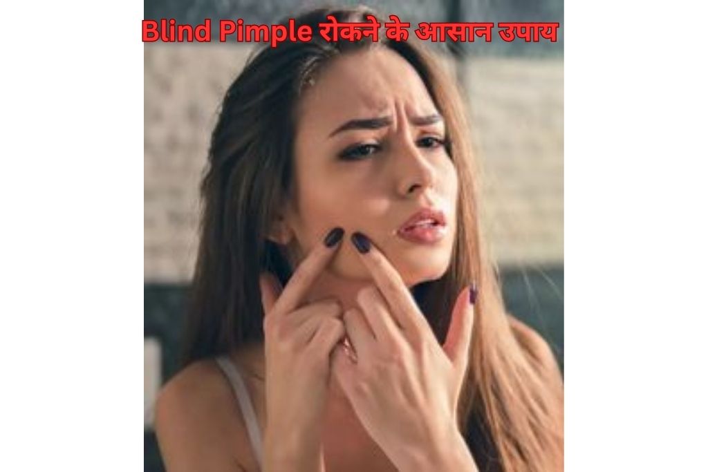 Blind Pimple