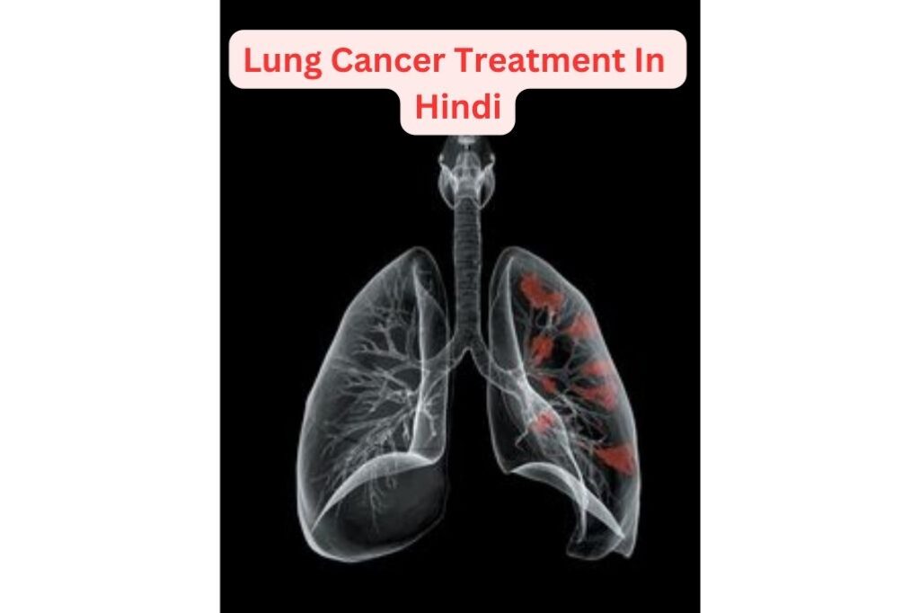 Lung Cancer Treatment In Hindi